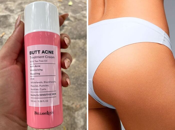 Bikini Season Got You Feeling A Little Cheeky? This Butt Acne Clearing Lotion Will Have Your Backside Beach-Ready In No Time!