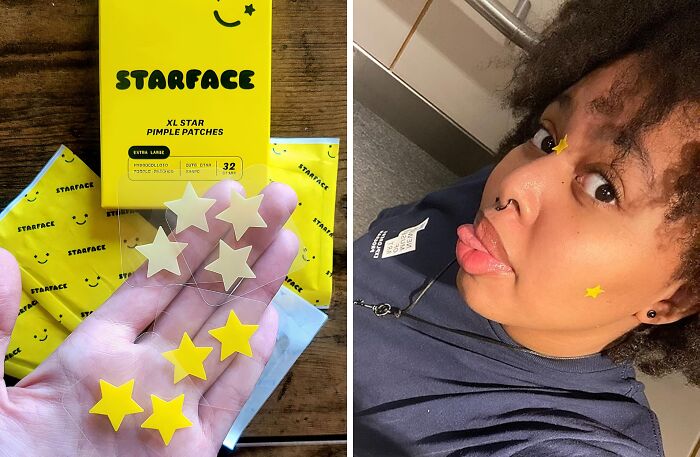 Breakouts Trying To Steal The Spotlight? These Starface Hydro-Stars Pimple Patches Will Zap Those Zits Into Oblivion, Leaving You With A Complexion That's Out Of This World!