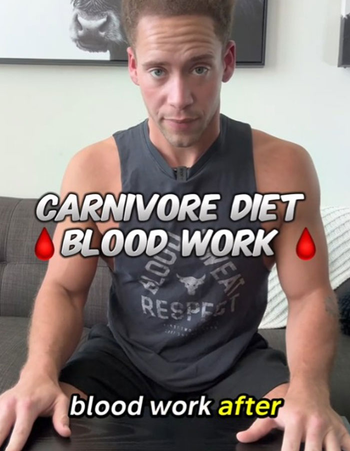 "So Everybody Was Right": Man Gets Mixed Reactions After Sharing Results Of Carnivore Diet