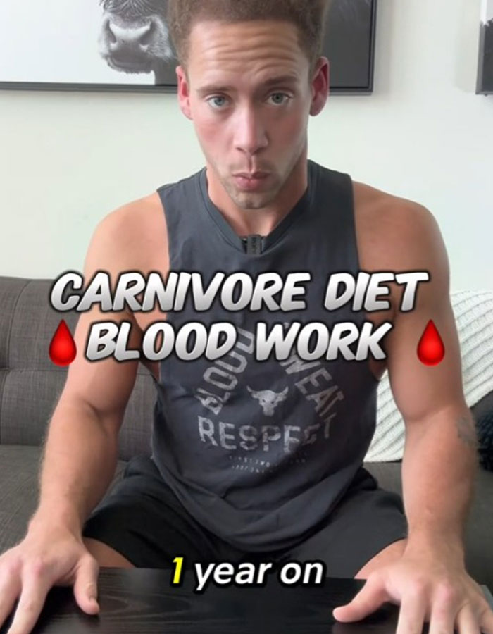 "So Everybody Was Right": Man Gets Mixed Reactions After Sharing Results Of Carnivore Diet