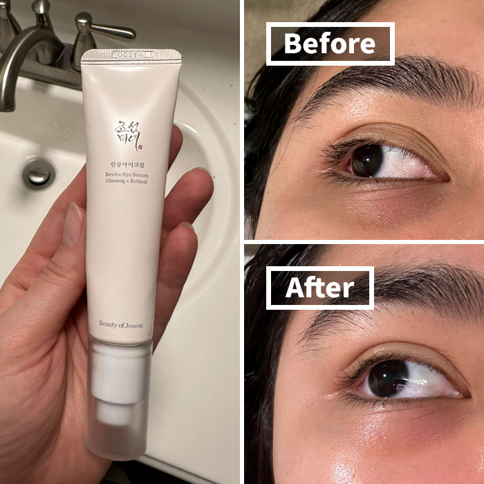 Tired Eyes? This Beauty Of Joseon Eye Serum Is Your Wake-Up Call, Banishing Puffiness And Dark Circles Like A K-Drama Hero Rescuing A Damsel In Distress