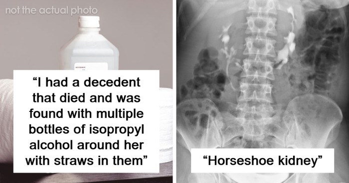 19 Interesting Or Shocking Discoveries Forensic Scientists Came Across On Their Job