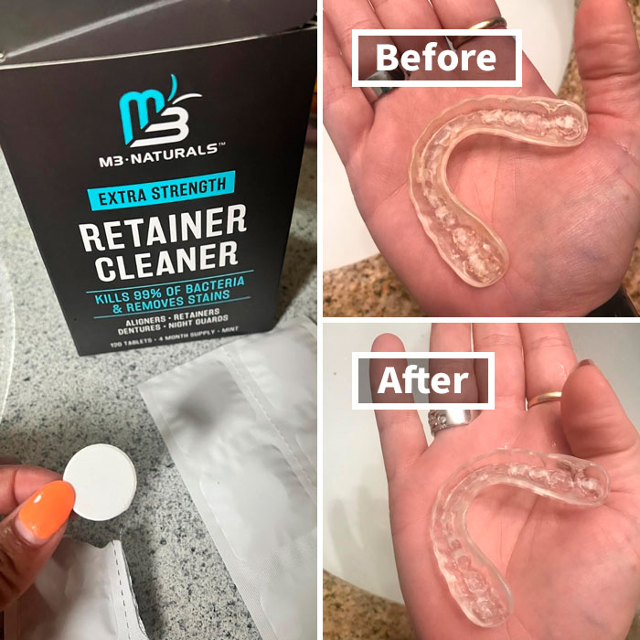 Your Retainer's About To Be Fresher Than Your Breath After A Mojito! These Cleanser Tablets Will Banish Bad Odors And Keep Your Smile Sparkling