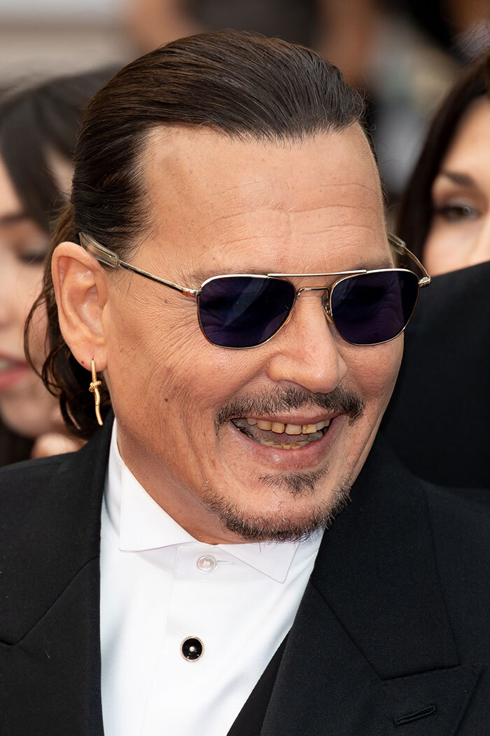 Johnny Depp’s New Pearly Whites Shine In Video After His “Rotting ...