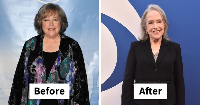 “I’m Ashamed”: Kathy Bates Reveals 100 lb Weight Loss And Explains How It Impacted Her Life