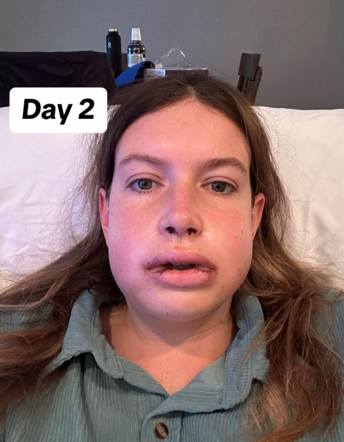 Woman Stuns Viewers With Surgery Results After Having Her “Jaw Of An 80-Year-Old” Fixed