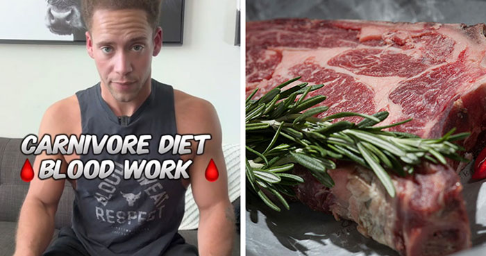 “So Everybody Was Right”: Man Gets Mixed Reactions After Sharing Results Of Carnivore Diet