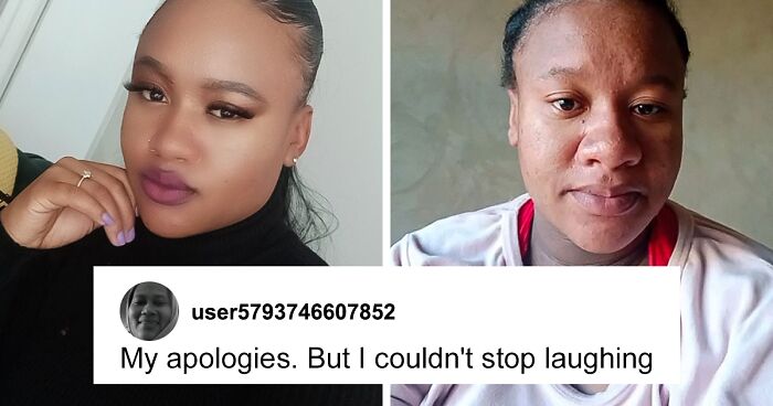 “I’m So Scared”: South African Woman’s Dramatic ‘Pregnancy Nose’ Transformation Goes Viral