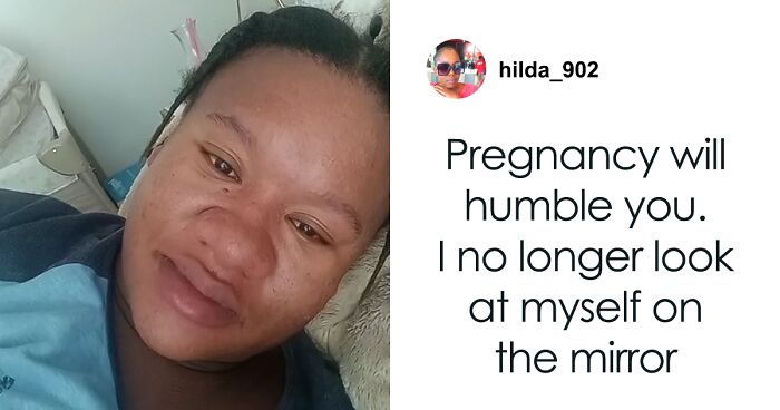 Netizens Stunned By Woman’s Dramatic Pregnancy Transformation: “Are You Sure That’s You?”