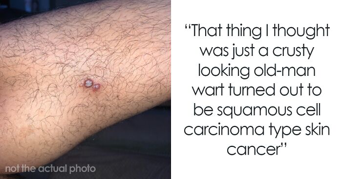 30 Times People Didn’t Think Their Symptoms Were A Big Deal, But They Were