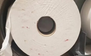 Viral Pic Of Bloody Toilet Paper Soiled By Drug Users Sparks HIV Misinformation, Doctor Reacts