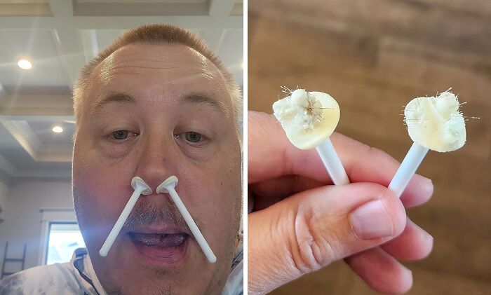 Tackle The Pesky Problem Of Nasal Hair With This Discreet Nose Wax Kit - A DIY Solution That Helps You Remove Unwanted Hair From The Comfort Of Your Own Home