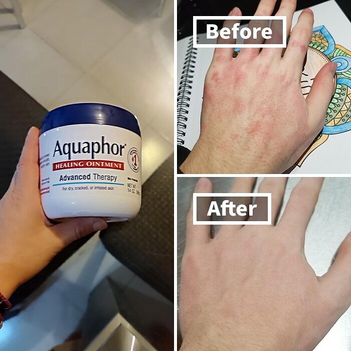  Aquaphor Healing Ointment Is A Tried And Tested Favorite That Remains A Trending Choice For Savvy Shoppers