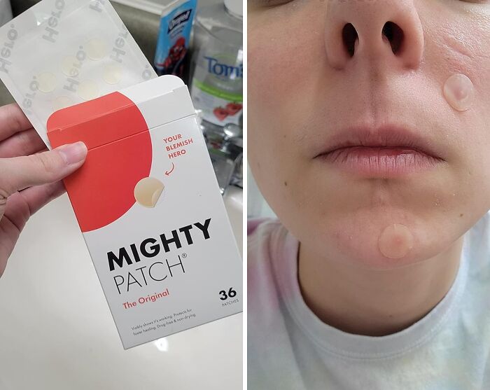 Your Zit Zapper Has Arrived! The Mighty Patch Hero Cosmetics Patch Is The Secret Weapon For Banishing Pesky Pimples Overnight