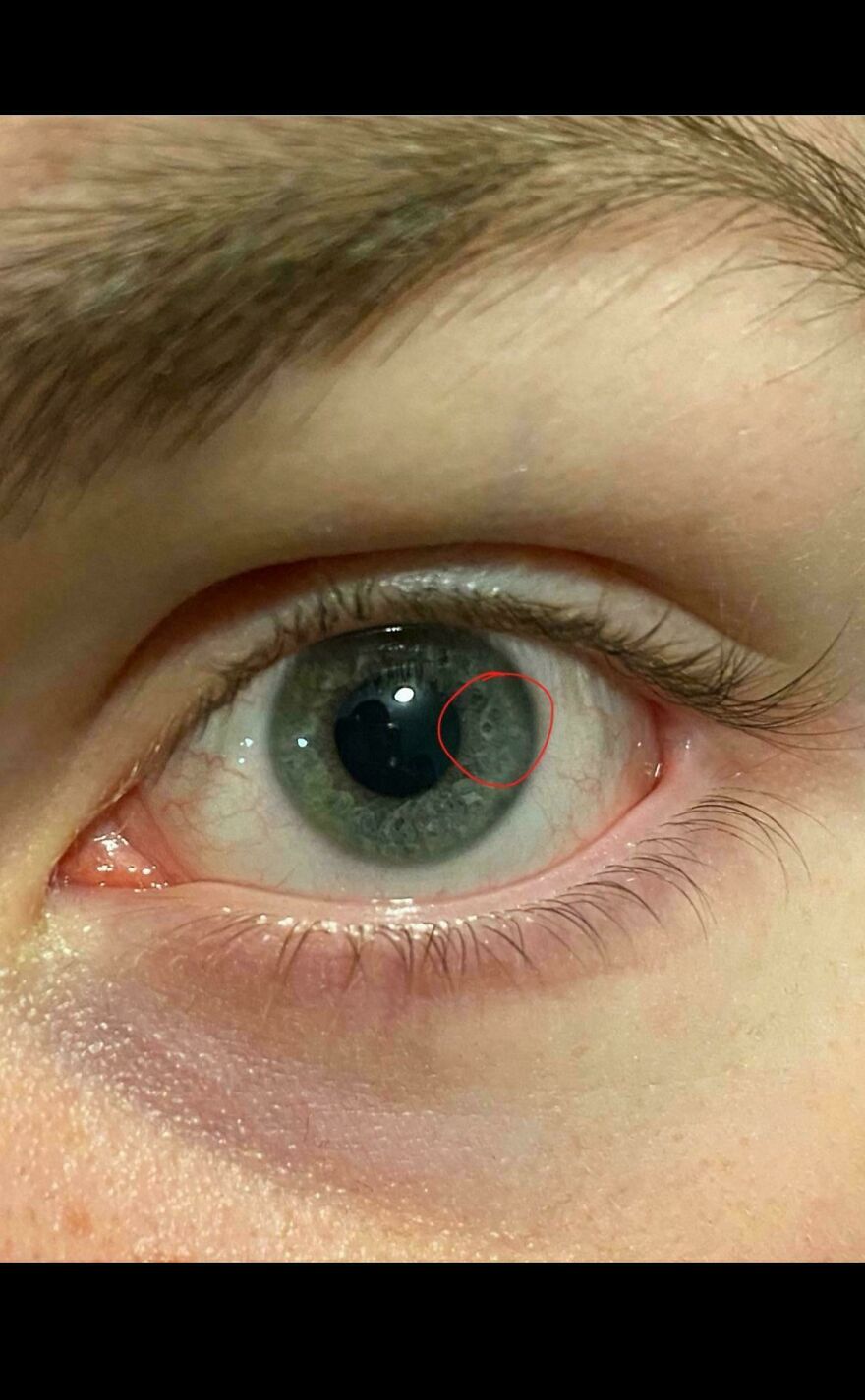 My BF’s Left Eye Has A 6 In It