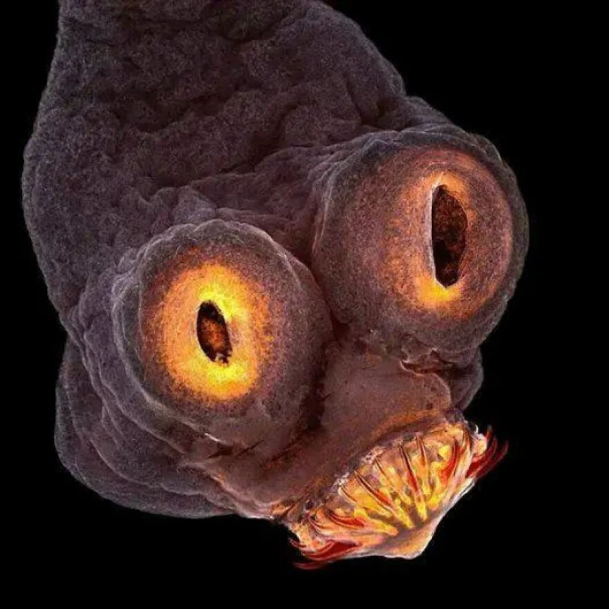 The Face Of A Tapeworm Under An Electron Microscope