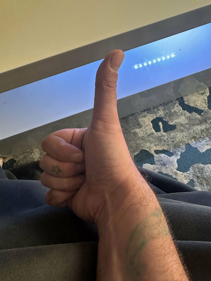 Someone Previously Has Said I Have Long Thumbs. I Never Realized Until I Was 38. Guess I Don’t Look At Thumbs Often Enough