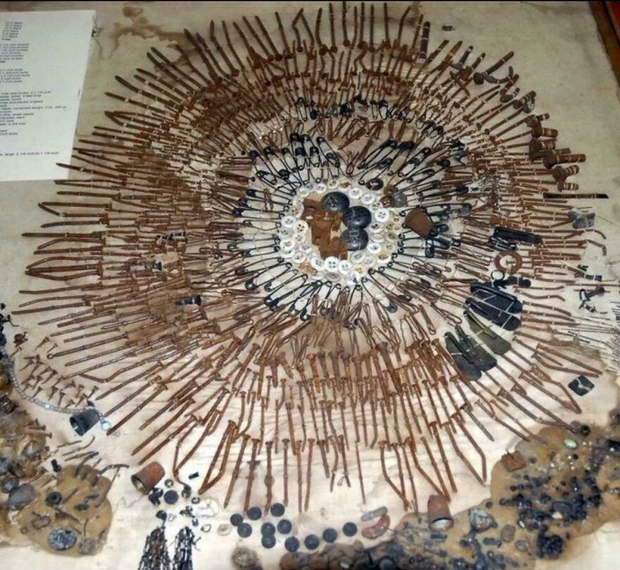 The Stomach Contents Of A Psychiatric Patient Who Suffered From Pica Disorder, A Disease Characterized By An Appetite For Inedible Objects