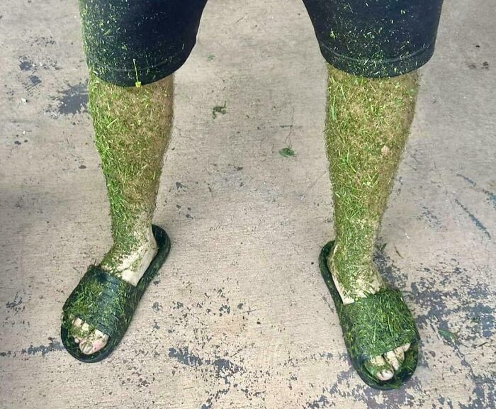 My Legs After Mowing My Lawn While It Was Still Wet