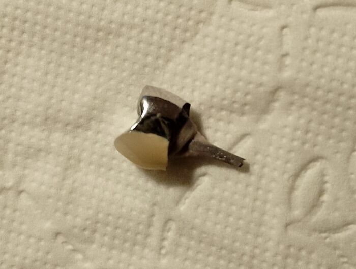 Felt Something Odd While Eating. Then This Fell Into My Food. This Is The Majority Of A Dental Implant That I Got About 8 Years Ago. Looks Like My Week Will Start With A Visit To The Dentist