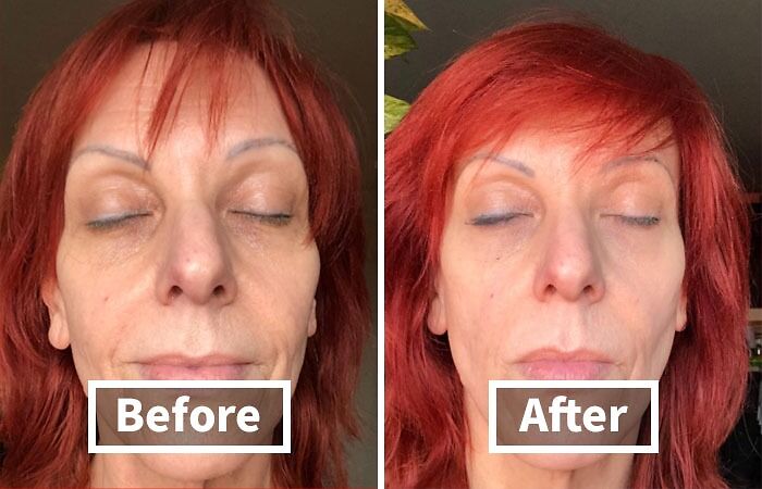 Before and after images of a woman with red hair, showcasing cheap fixes for skin appearance.