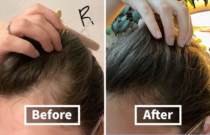 Give Your Lackluster Locks A New Lease On Life With This Hair-Reviving Anti-Thinning Biotin Shampoo & Deep Moisturizing Conditioner That'll Have You Flipping Your Hair Like You're In A Shampoo Commercial