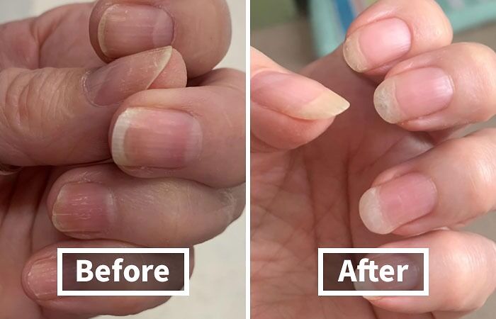 For When Your Nails Are As Brittle As Your Patience, This Hard As Hoof Nail Strengthening Cream Is The Quirky Solution That'll Make Your Nails As Tough As, Well, A Horse's Hoof