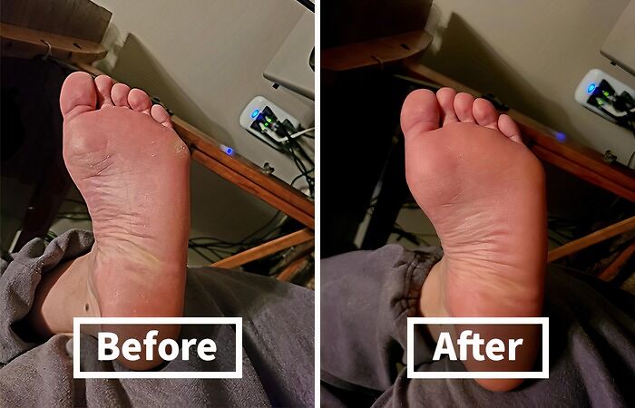 Tired Of Your Feet Looking Like They Belong On A Hobbit? This Foot File Callus Remover Will Fix You Right Up