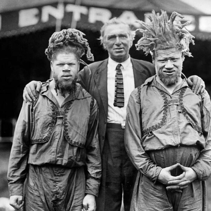 George And Willie Muse, Two African American Brothers Who Were Kidnapped As Children In 1899 And Forced To Perform As Sideshow Attractions Because They Were Albinos