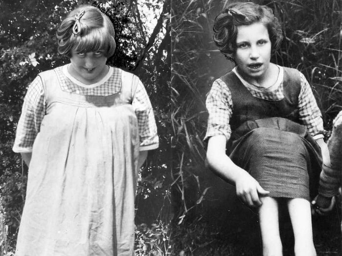 The Mentally Disabled Hidden Cousins Of Queen Elizabeth II