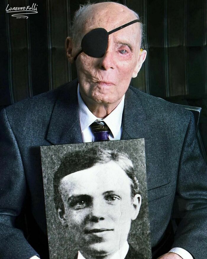 German Ww1 Veteran Hans Lange Holds A Portrait Of Himself As A 19 Year Old In 1918