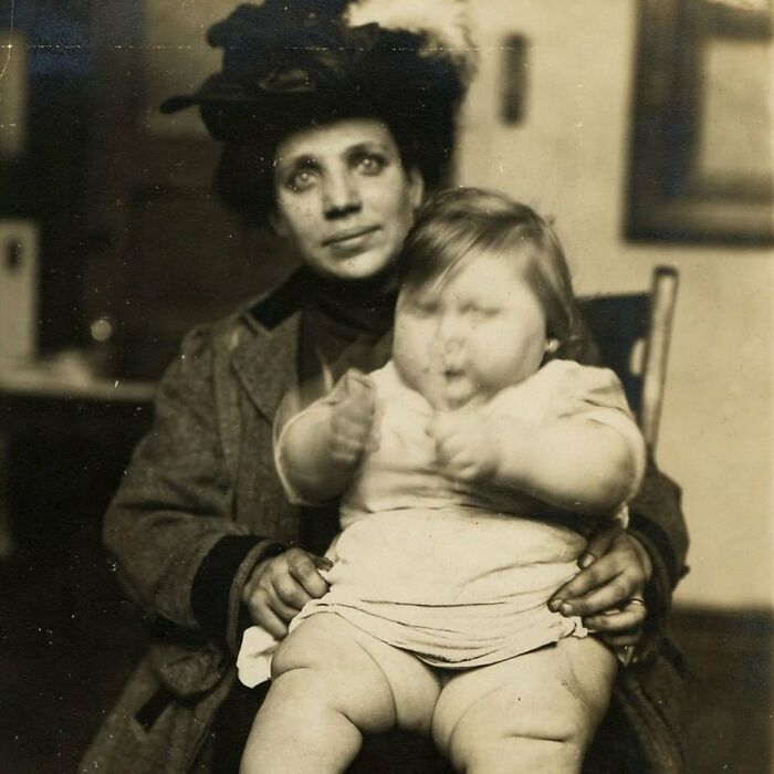 Ellis Island Immigrants Circa 1910. At The Time Of This Photo The Child Was 11 Months Old And Weighed 55 Pounds (25 Kilograms)