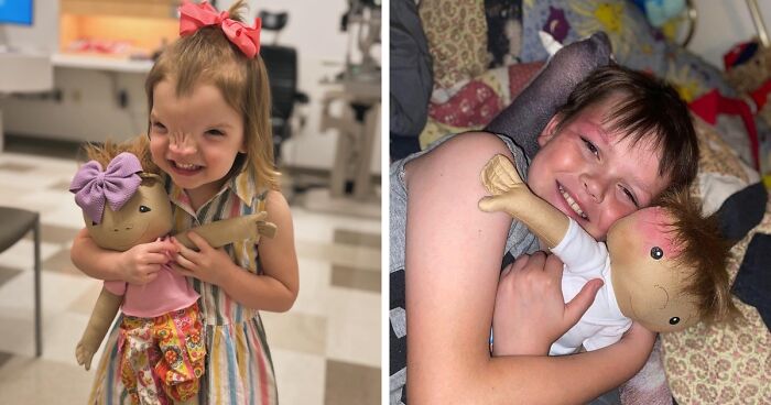 This Woman's Dolls Are Bringing Smiles To Kids With Rare Health Conditions (26 New Pics)