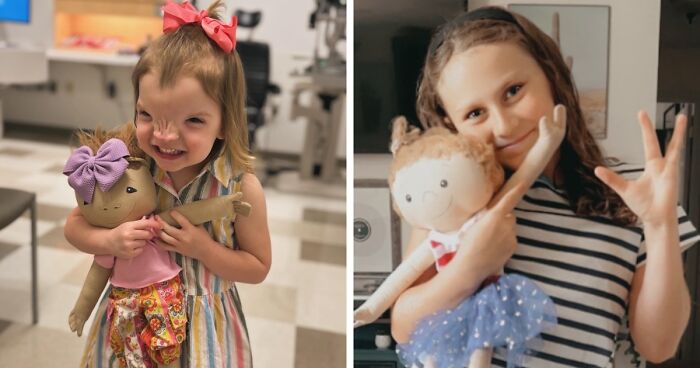 26 Dolls That This Woman Created For Kids With Rare Conditions To Feel Included And Represented (New Pics)