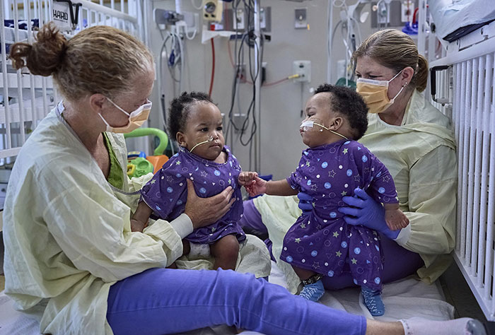 "So Grateful": Mom Of Successfully Separated Conjoined Twins Reveals They Went Home After A Year