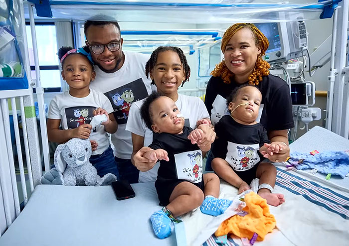 "So Grateful": Mom Of Successfully Separated Conjoined Twins Reveals They Went Home After A Year