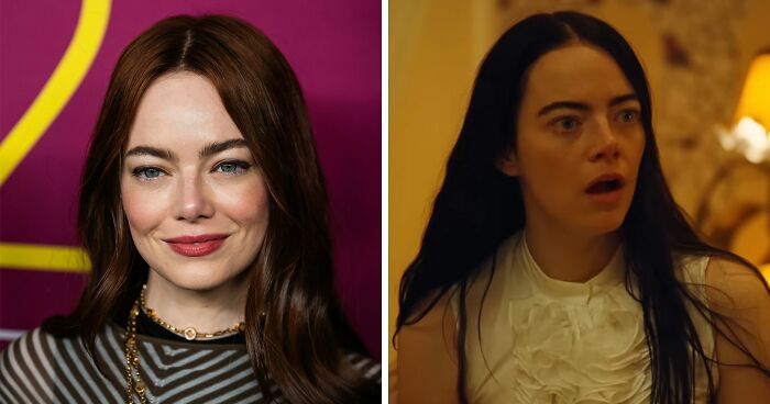 “Emma Stone Is Definitely Bald!”: Fans Convinced Actress Shaved Head For New Role