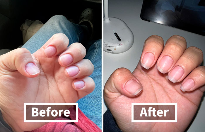 "Have you tried using jojoba oil on your nails? It helps them grow like crazy if you want them longer. You have to be consistent and apply it a few times a day but it works!" - vanimbeauty