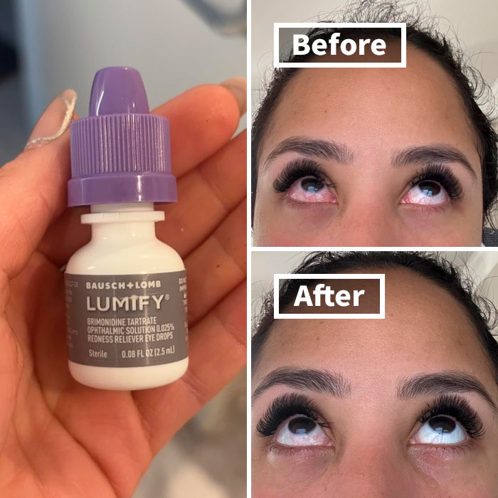 Say Goodbye To Pink Eyes With The Lumify Redness Reliever Eye Drops - Temporary Relief From Winter Woes!