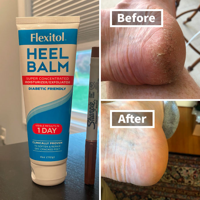  Flexitol Heel Balm - Cracked Heels? What Cracked Heels?