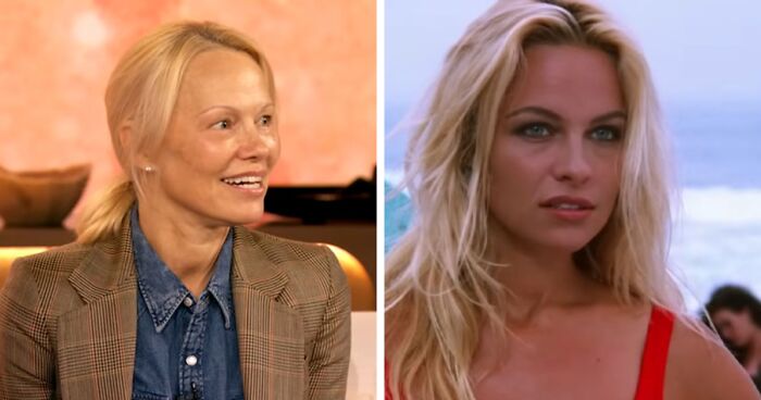 “She Looks Gorgeous”: Pamela Anderson Gets Love For Embracing Makeup-Free Look