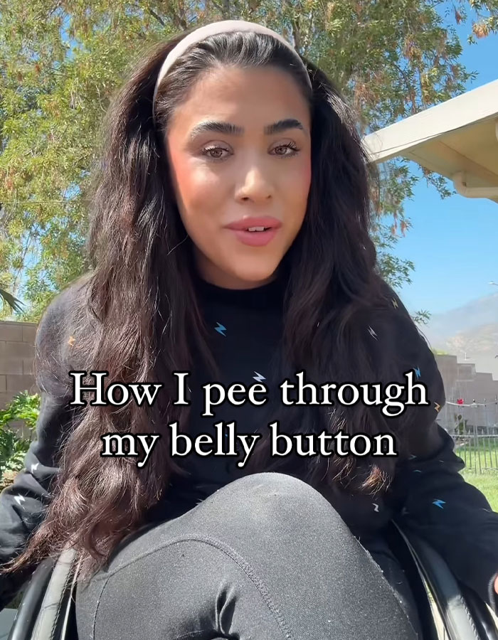 “It Was Worth The Pain”: Quadriplegic Influencer Talks About Peeing Through Her Belly Button