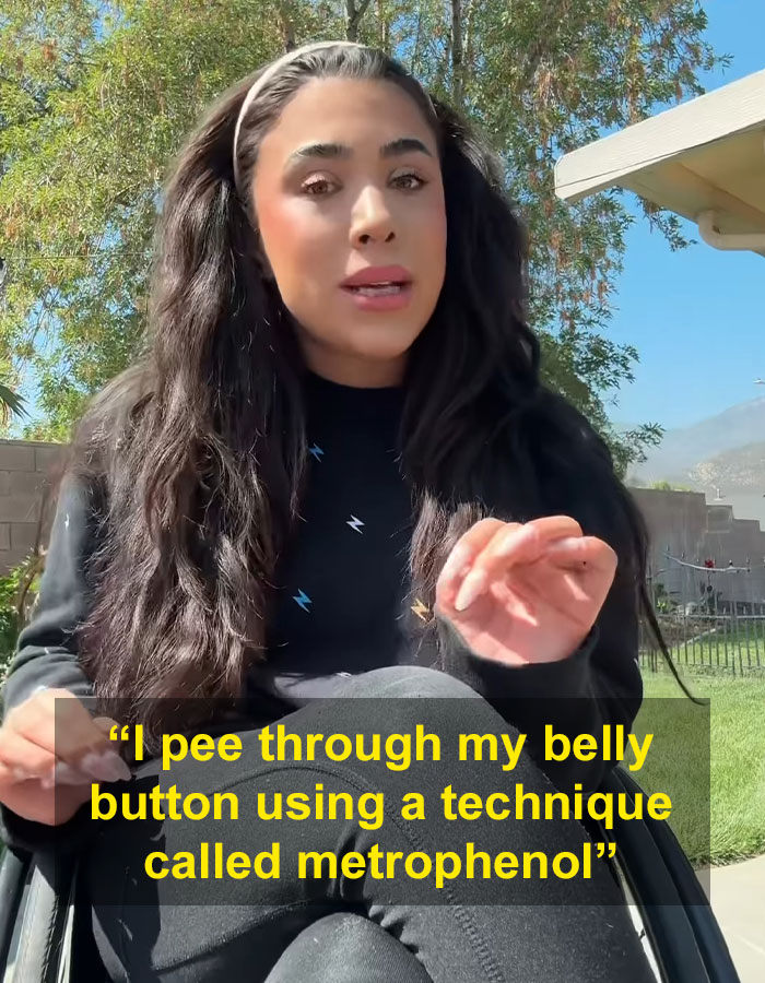 “It Was Worth The Pain”: Quadriplegic Influencer Talks About Peeing Through Her Belly Button