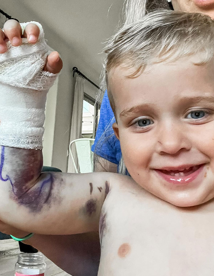 "That's Outrageous!": Parents Of 2YO Bitten By Rattlesnake Charged $300k For Life-Saving Cure