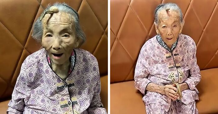 107-Year-Old Woman Stuns Internet With Massive Horn—Doctors Warn Of Potential Cancer Risk