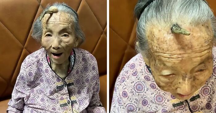 107YO Stuns Internet With 4-Inch 