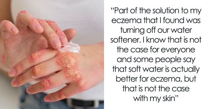 Woman Suspects Hubby Turned On Soft Water To “Test” Her Eczema, Worries About Her Marriage