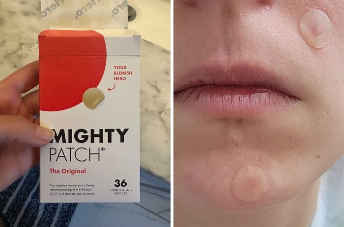 Zap Zits And Banish Blemishes With The Award-Winning Mighty Patch Pimple Patches, A Discreet And Effective Solution For Acne-Prone Skin