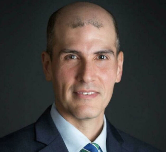 A man with a unique hair pattern in a suit, related to tragic hair accidents.