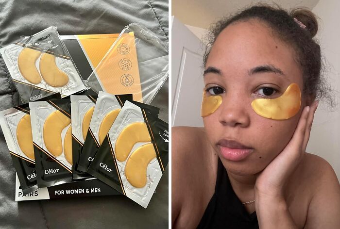 Tired Of Looking Like You Haven't Slept Since The Stone Age? These Gold Under-Eye Patches Will Banish Those Dark Circles And Have You Looking Bright-Eyed And Bushy-Tailed